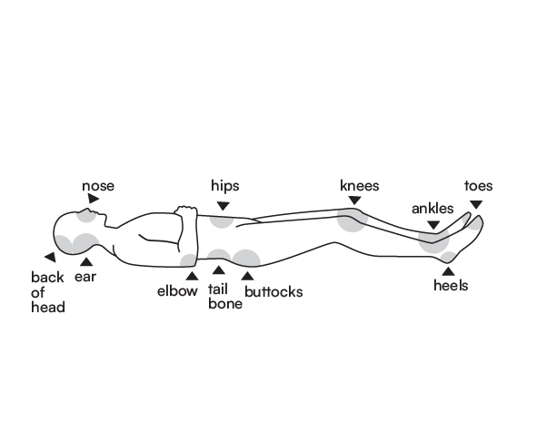This is a diagram of a person lying on their back. The diagram shows the areas of the body at risk of pressure injury when lying down (back of head, shoulder, elbow, buttocks, and heel).