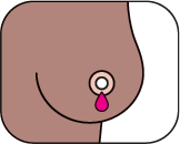 Breast showing nipple discharge